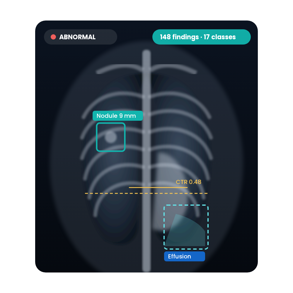 Rayscape radiology AI highlighting findings on a chest X-ray